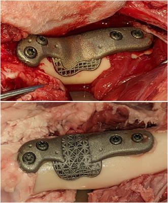 Reducing the prosthesis modulus by inclusion of an open space lattice improves osteogenic response in a sheep model of extraarticular defect